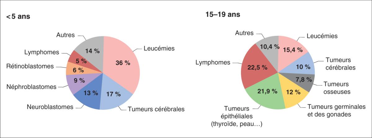 Fig. 27.1.Proportion des différents types de cancers de l’enfant et de l’adolescent selon l’âge.