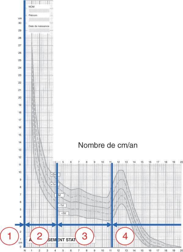 Fig. 1.1. Vitesse de croissance et les quatre phases de la croissance staturale.