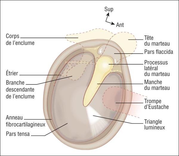 Fig. 32.1.  Otoscopie légendée (tympan droit).