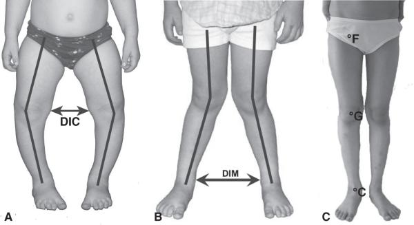 Fig. 4.8. Évolution du morphotype frontal des membres inférieurs.