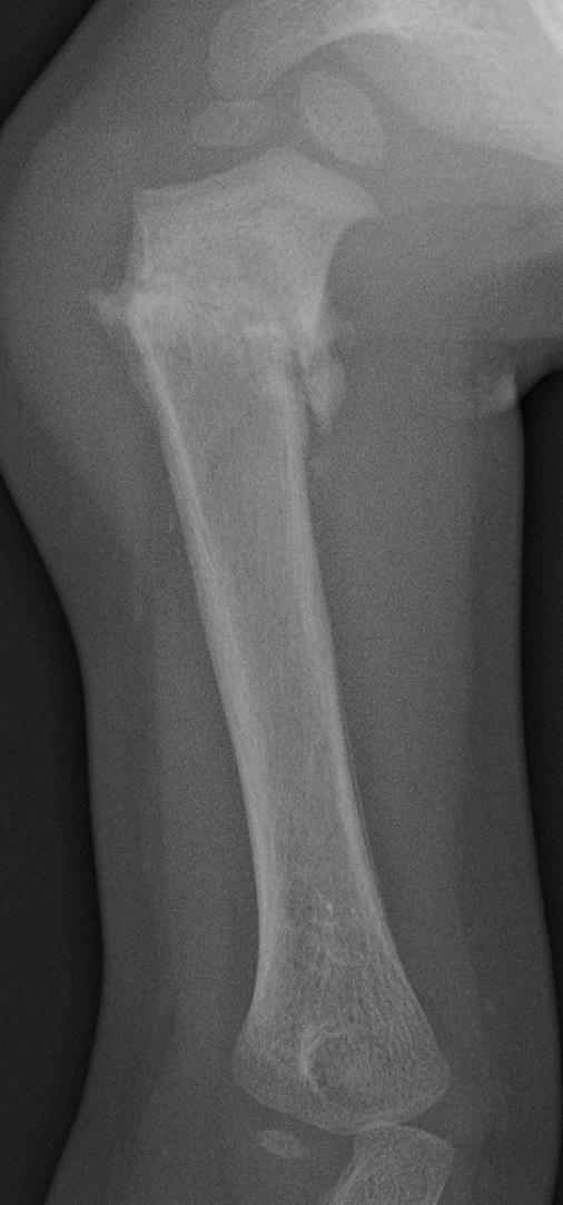 Fig. 71.4 Traumatisme infligé.