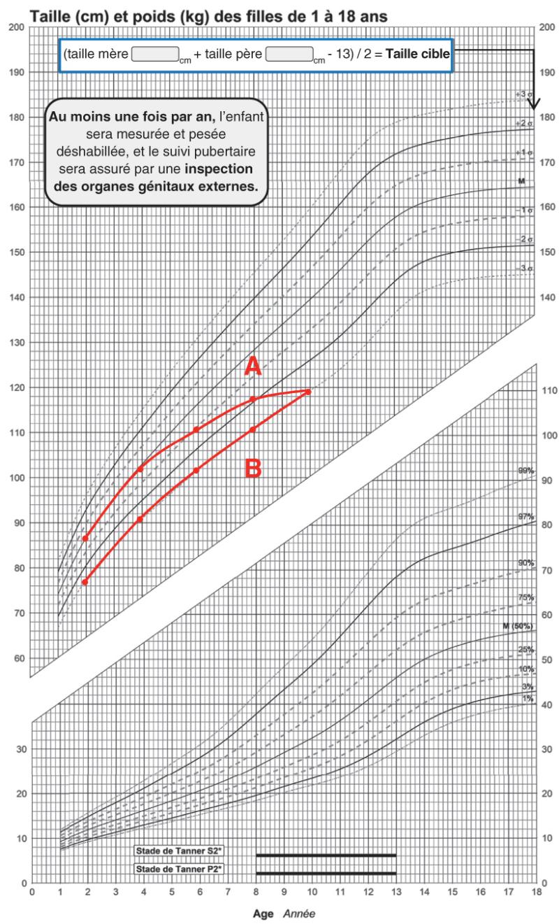 Fig. 1.3. Interprétation de la taille en fonction de la vitesse de croissance.