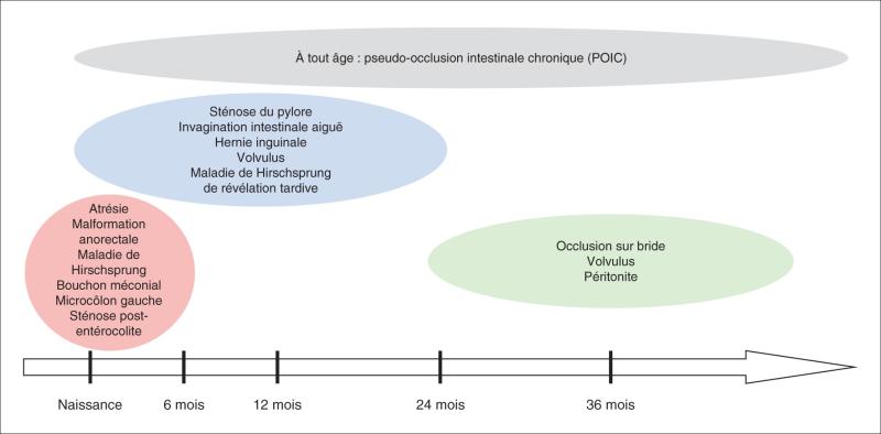Fig. 17.4.  Principales causes de syndromes occlusifs en pédiatrie.