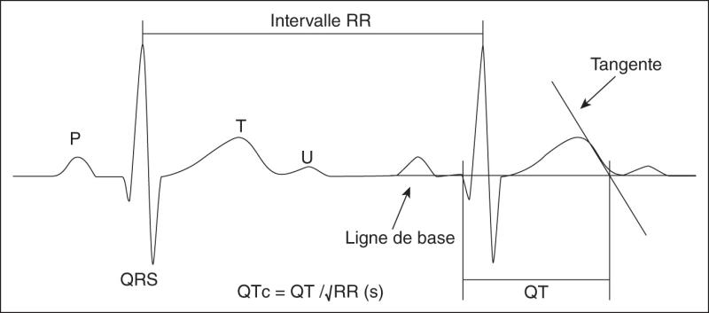 Fig. 66.1. Mesure du QT corrigé.
