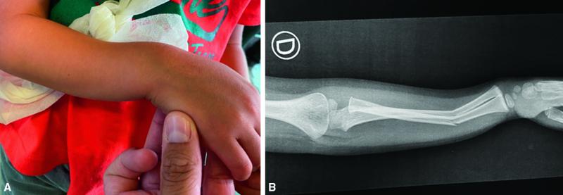 Fig. 71.8. Enfant de 4 ans consultant suite à une chute au centre de loisirs.