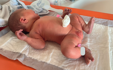 À la maternité, les premiers soins au nouveau né 